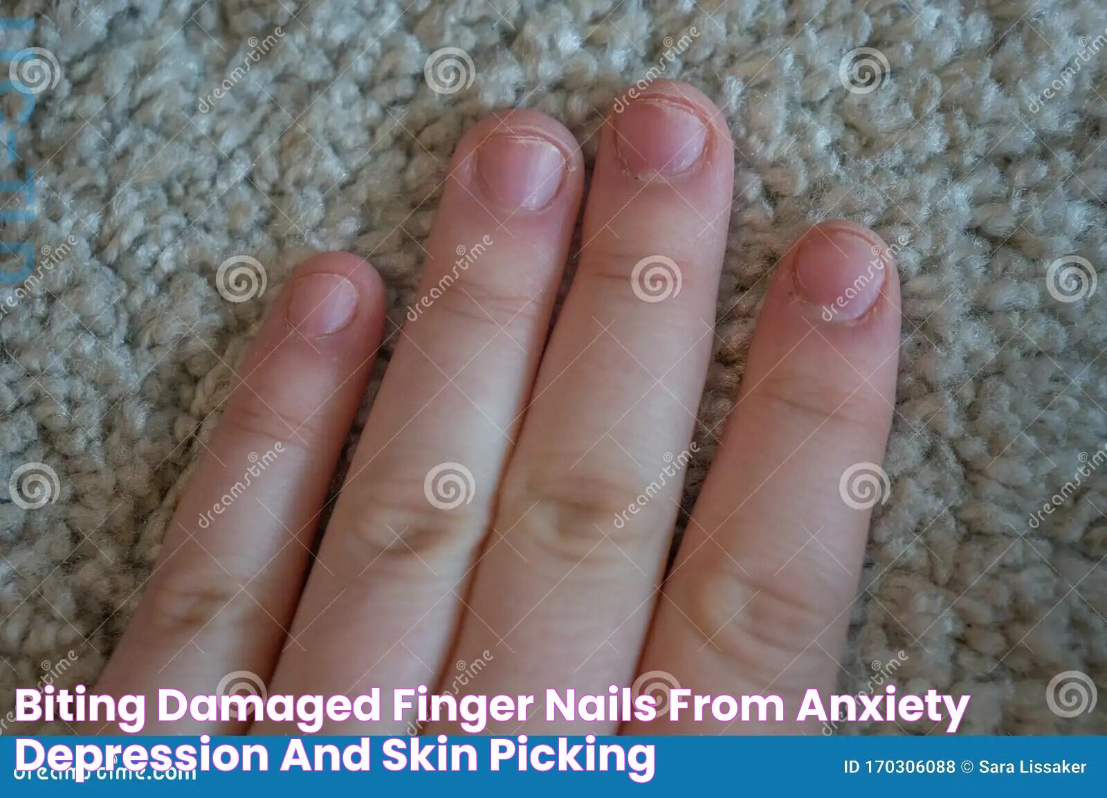 Insights Into Anxiety And Finger Picking: Causes, Effects, And Solutions