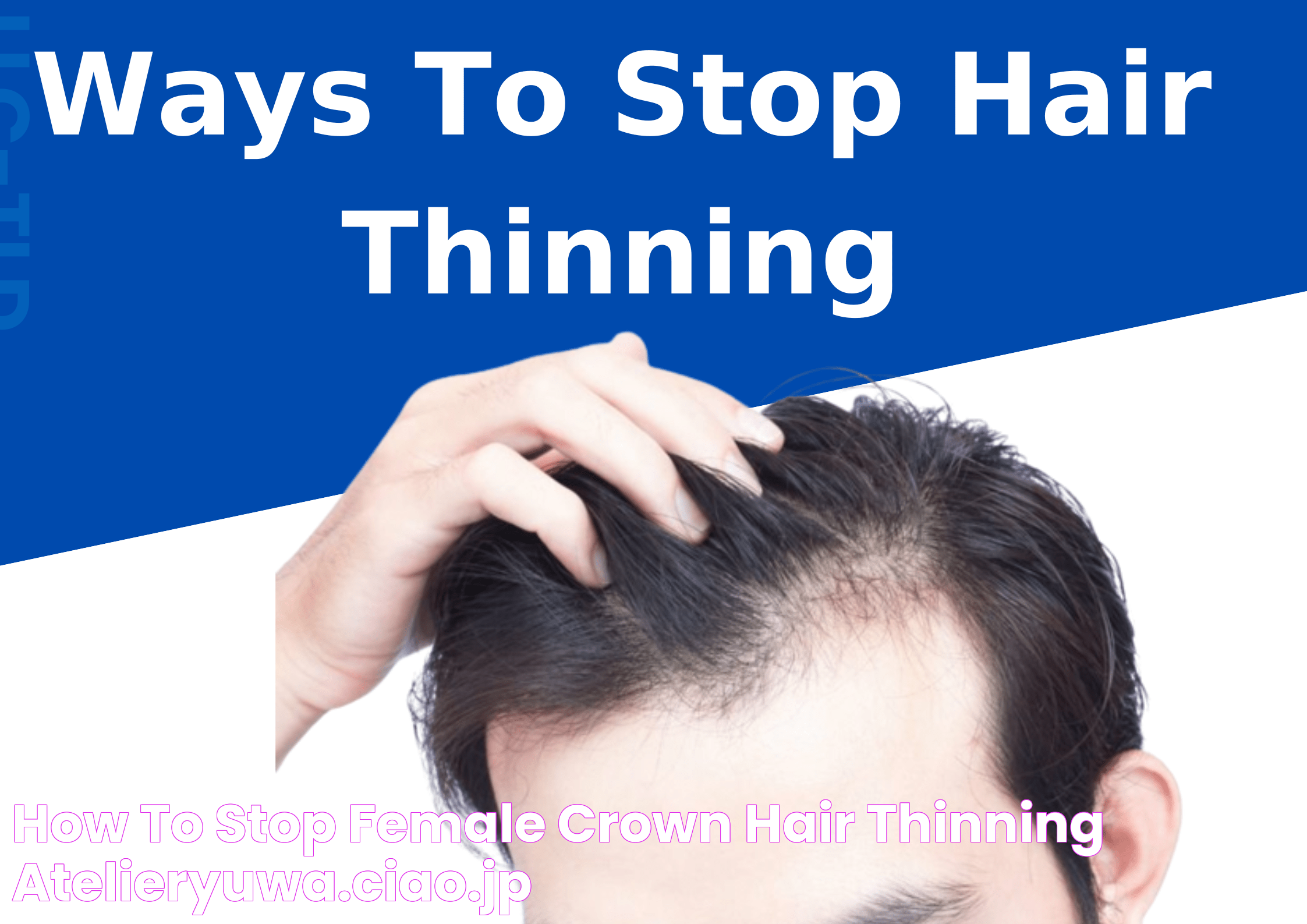 How To Stop Female Crown Hair Thinning? atelieryuwa.ciao.jp