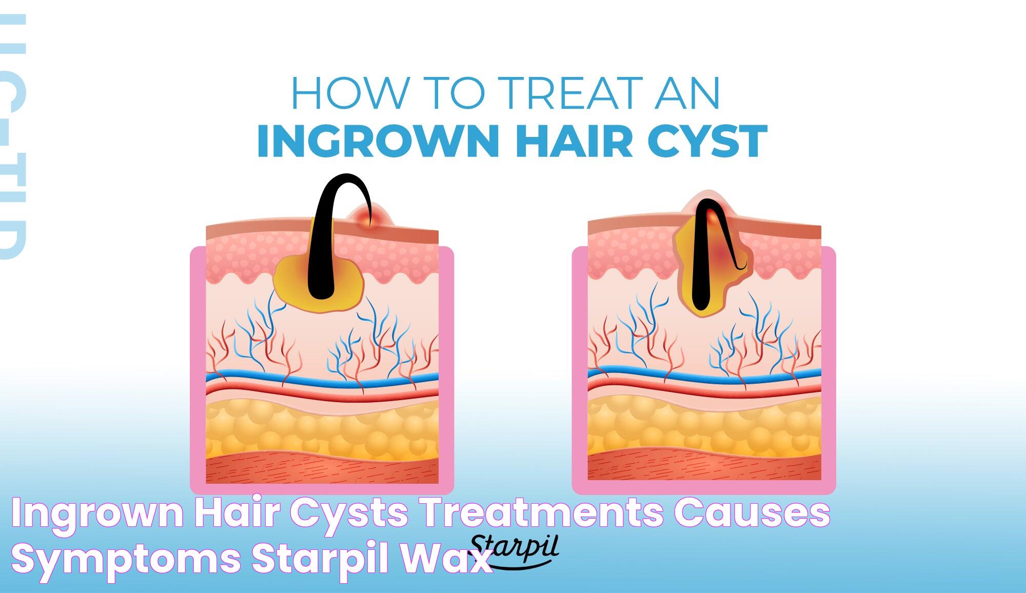 Effective Ways To Address A Troublesome Ingrown Hair: Tips And Solutions