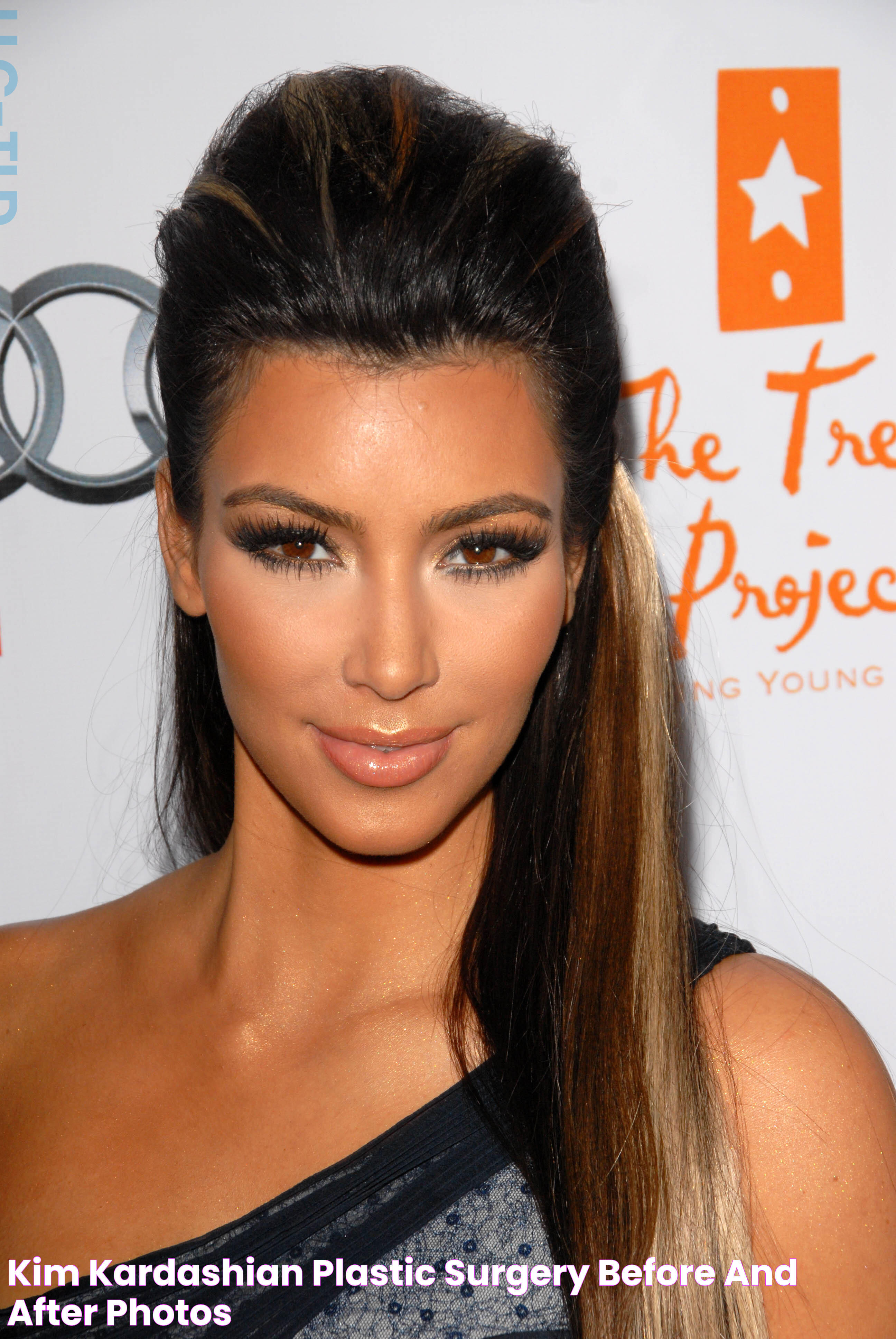 Kim Kardashian Plastic Surgery Before and After Photos