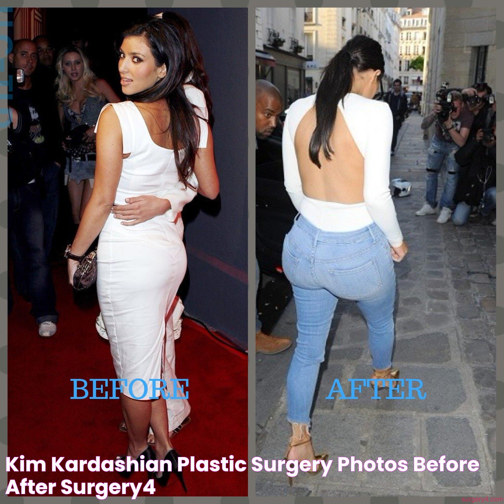 Kim Kardashian: Plastic Surgery Or Natural Beauty?