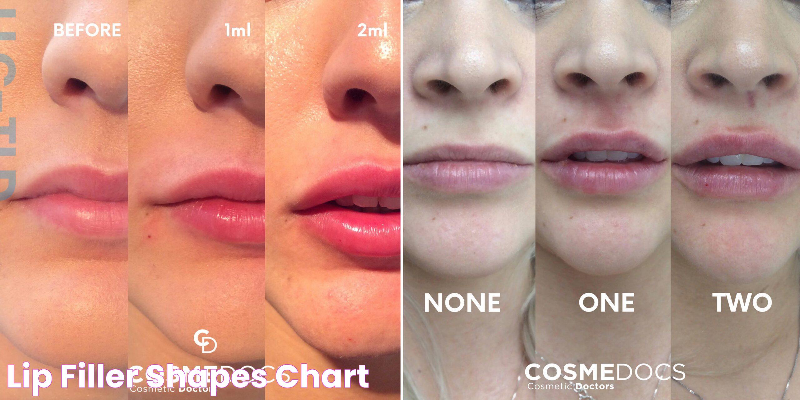 Enhance Your Look: Insights On .5 Lip Filler Before And After