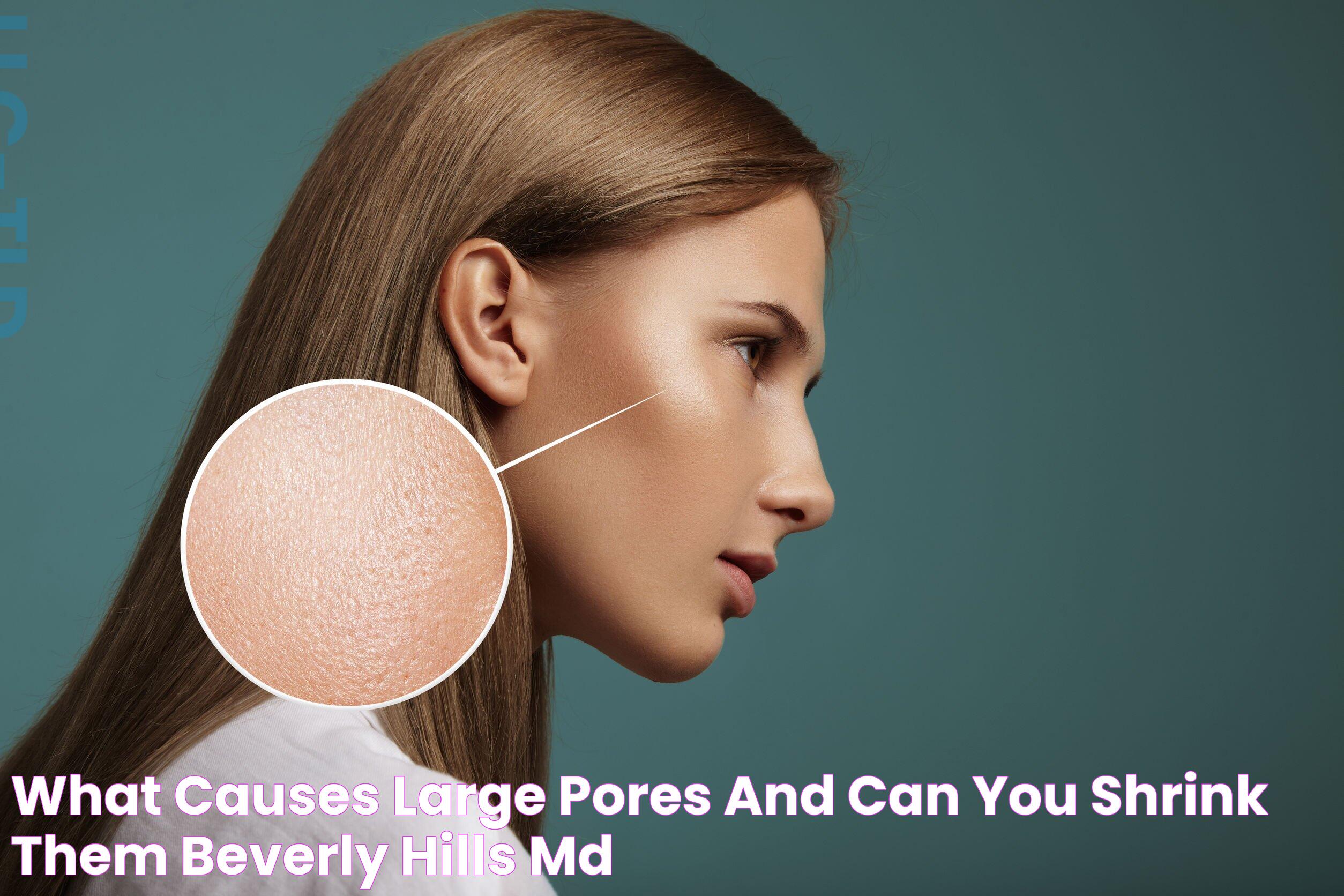 Effective Strategies To Reduce Look Of Pores: A Complete Guide