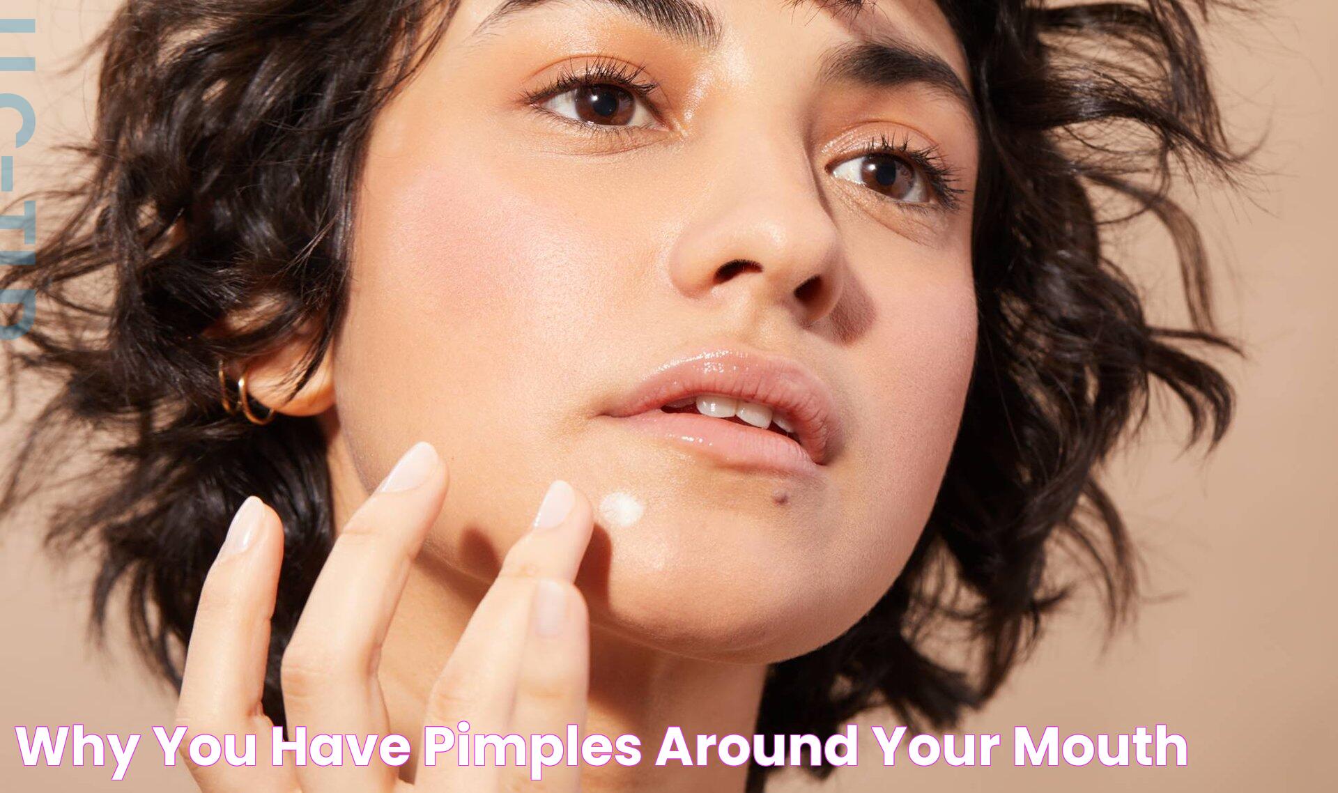 Why You Have Pimples Around Your Mouth