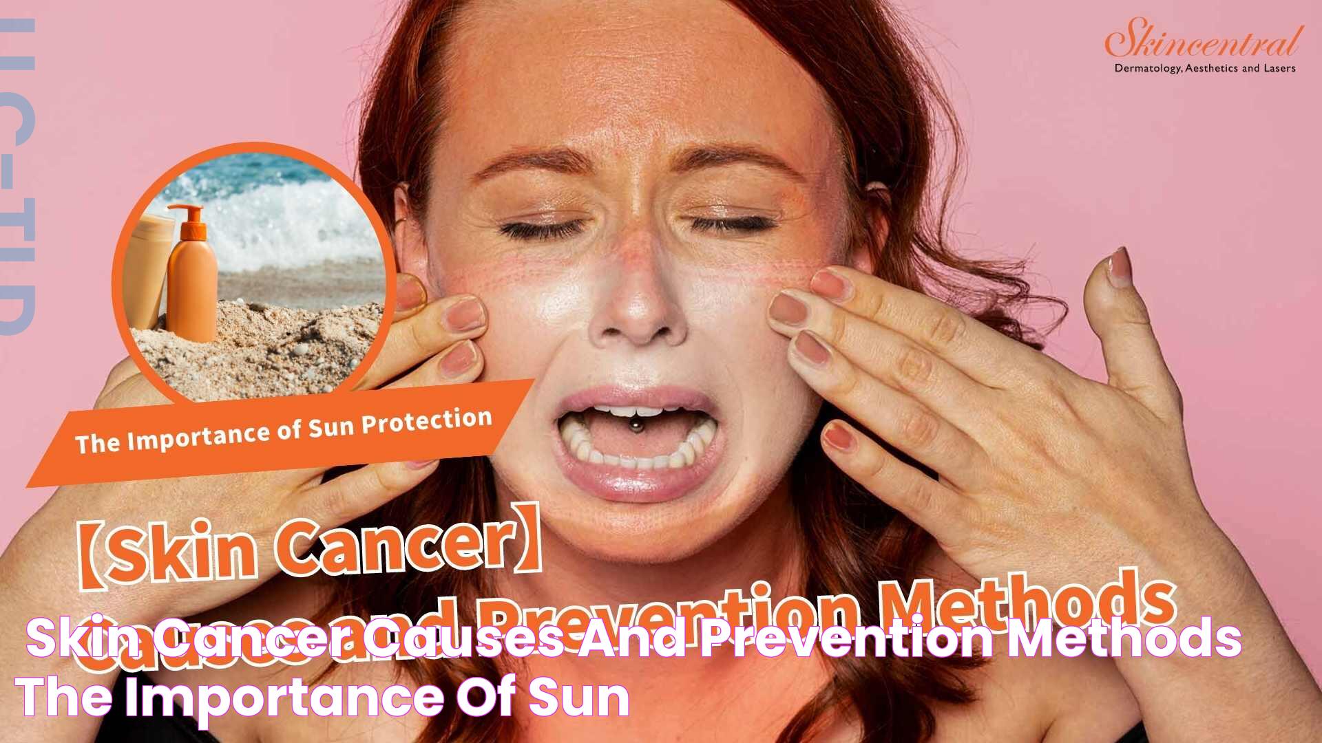 Factors Leading To Skin Cancer: Causes, Risk Factors, And Prevention Tips