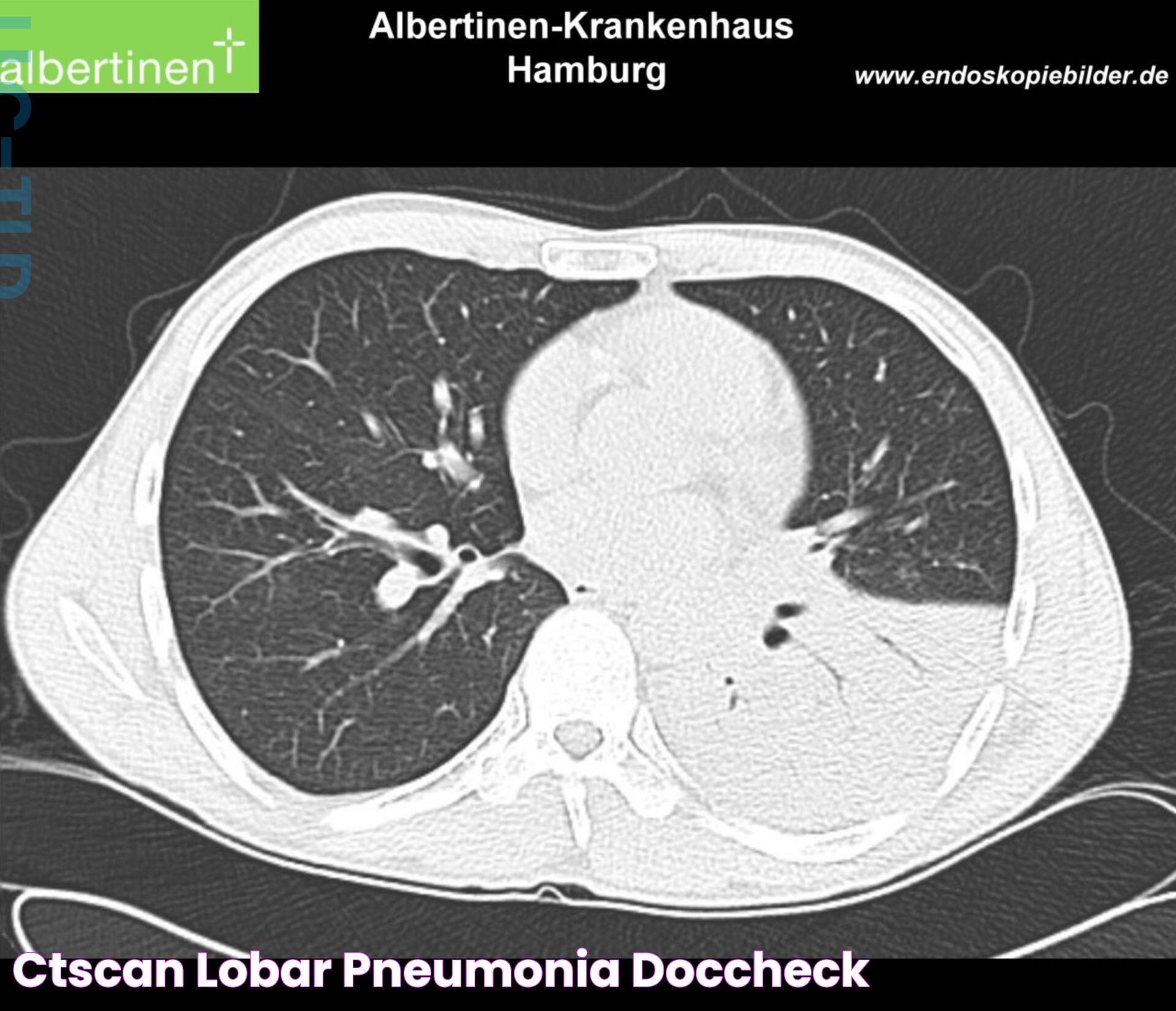 CT Doc: A Comprehensive Guide To Understanding And Utilizing CT Scans